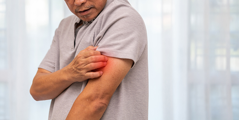 A man with severe itching due to his skin condition