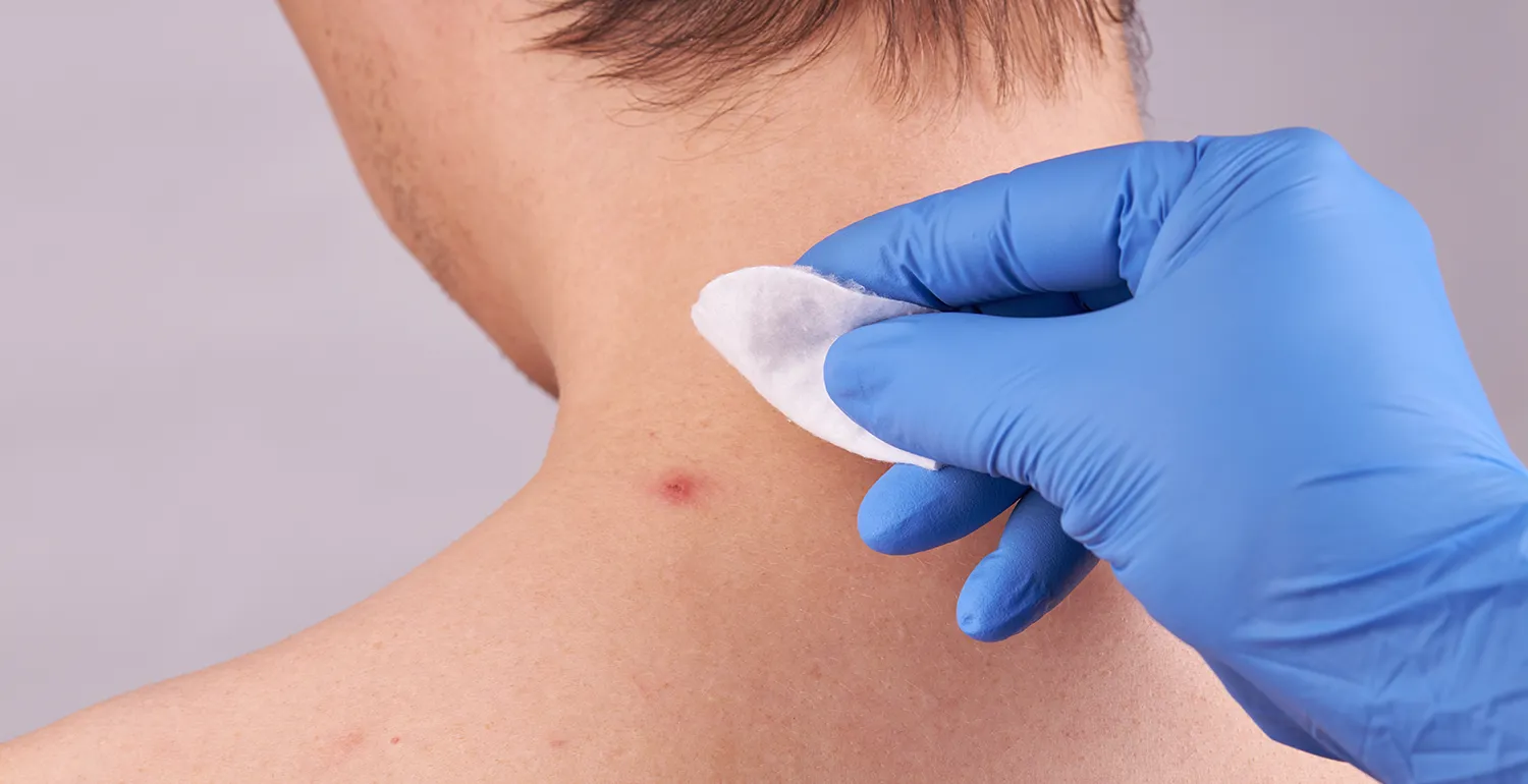 A doctor performing a skin assessment on a patient
