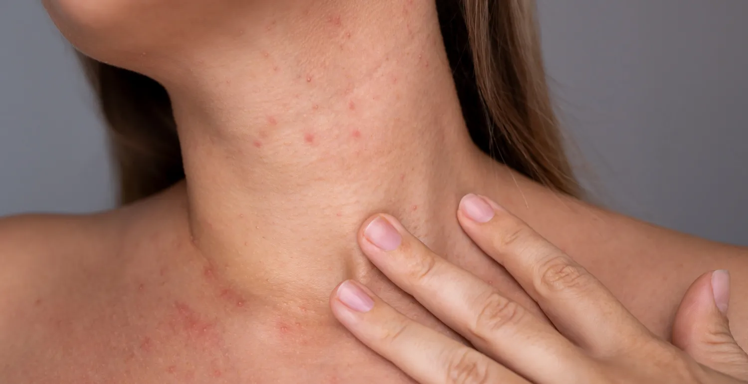 Consultation with a dermatologist with a medical skin cross section model