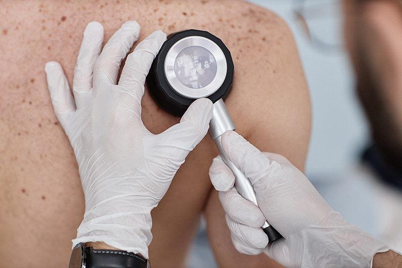 Patient undergoing a skin examination at a dermatology clinic