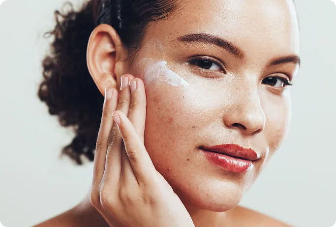 How is Acne Treated at TSN Dermatology?