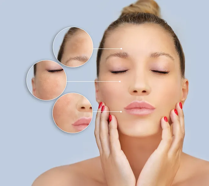 How Do Chemical Peels Work?