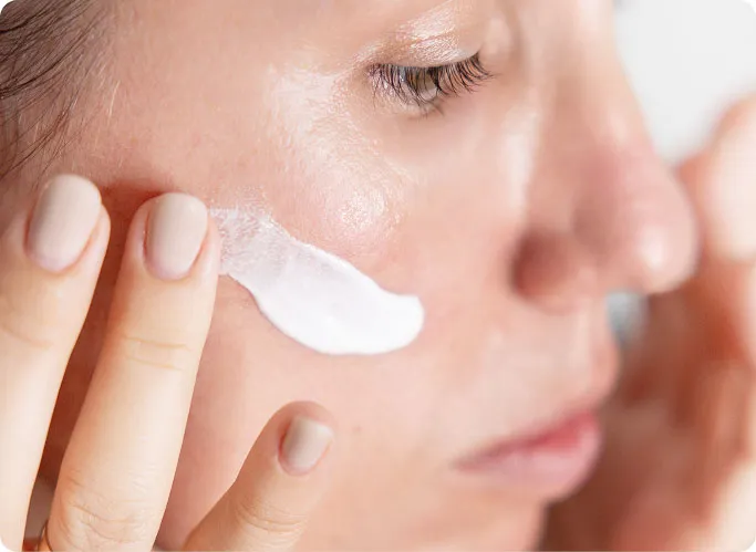 How Is Rosacea Treated at TSN Dermatology?