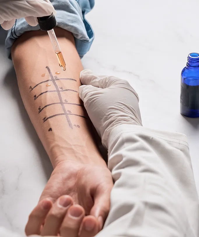 How are Skin Allergies Treated at TSN Dermatology?