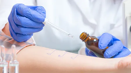 Skin Allergy Test & Treatment