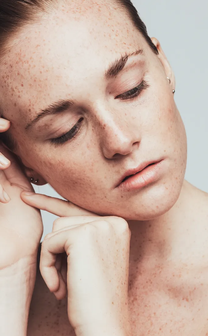 Common Symptoms of Skin Pigmentation to Look Out For