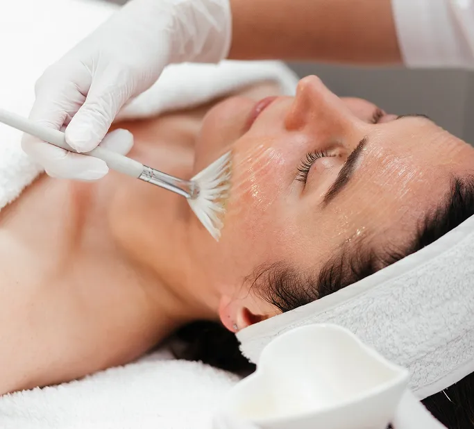 What Are Chemical Peels?